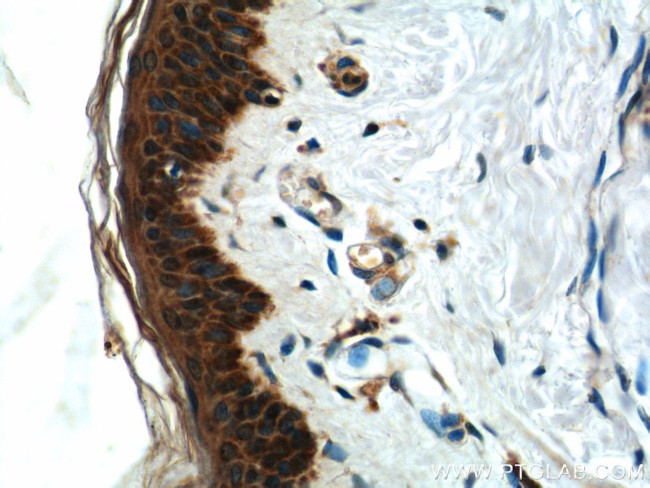 ACSF2 Antibody in Immunohistochemistry (Paraffin) (IHC (P))