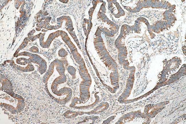 ACSF2 Antibody in Immunohistochemistry (Paraffin) (IHC (P))