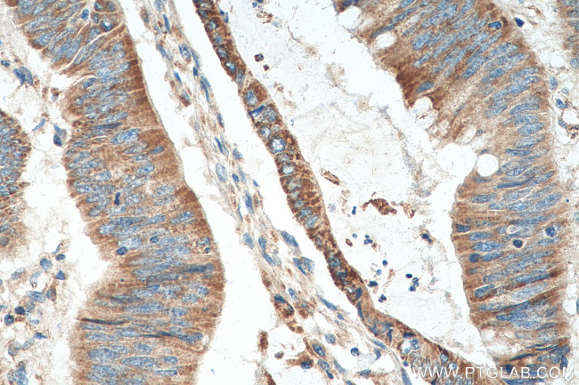 ACSF2 Antibody in Immunohistochemistry (Paraffin) (IHC (P))