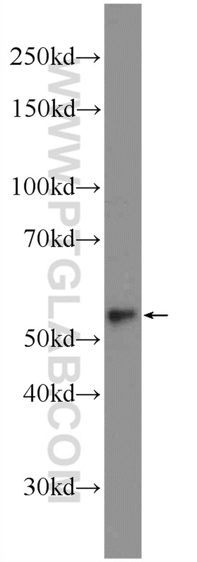 ACSF2 Antibody in Western Blot (WB)