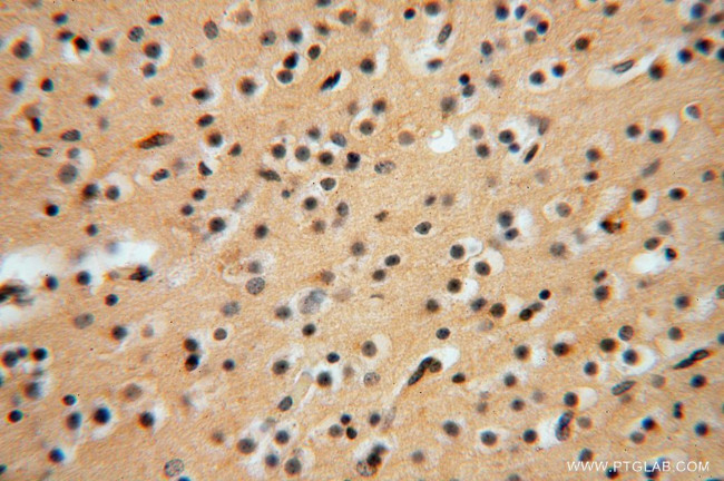 ATP6V1G1 Antibody in Immunohistochemistry (Paraffin) (IHC (P))