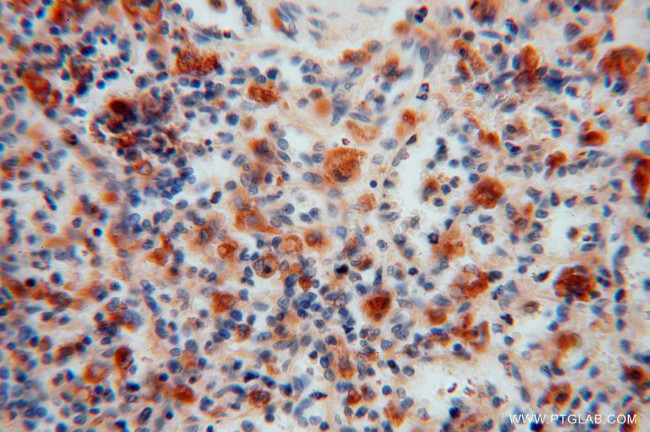 ATP6V1G1 Antibody in Immunohistochemistry (Paraffin) (IHC (P))