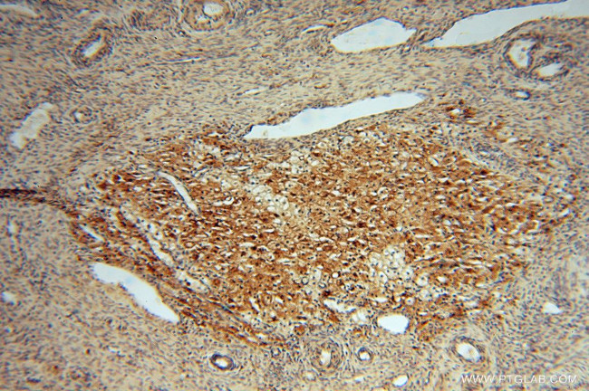 ATP6V1G1 Antibody in Immunohistochemistry (Paraffin) (IHC (P))