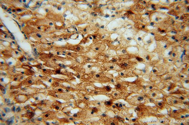 ATP6V1G1 Antibody in Immunohistochemistry (Paraffin) (IHC (P))