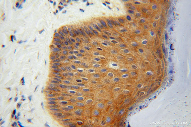 ATP6V1G1 Antibody in Immunohistochemistry (Paraffin) (IHC (P))