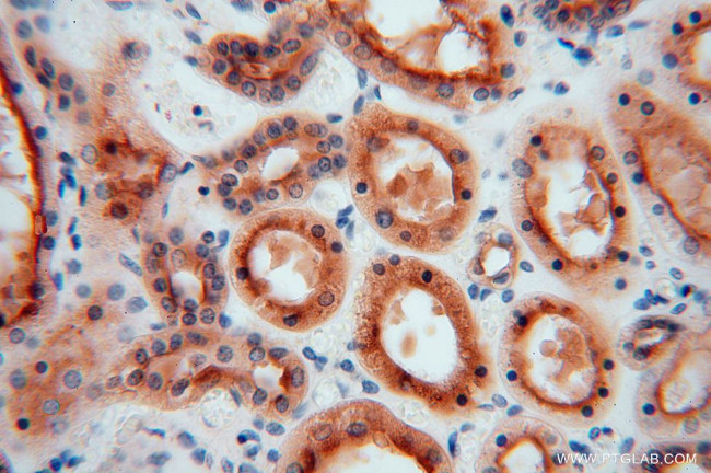 ATP6V1G1 Antibody in Immunohistochemistry (Paraffin) (IHC (P))