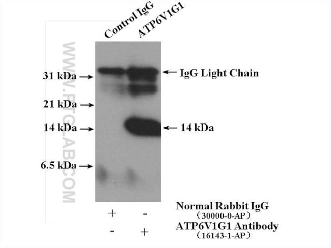 ATP6V1G1 Antibody in Immunoprecipitation (IP)