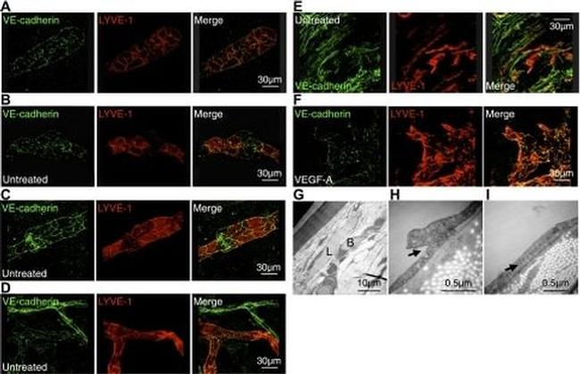 CD144 (VE-cadherin) Antibody in Immunohistochemistry (IHC)