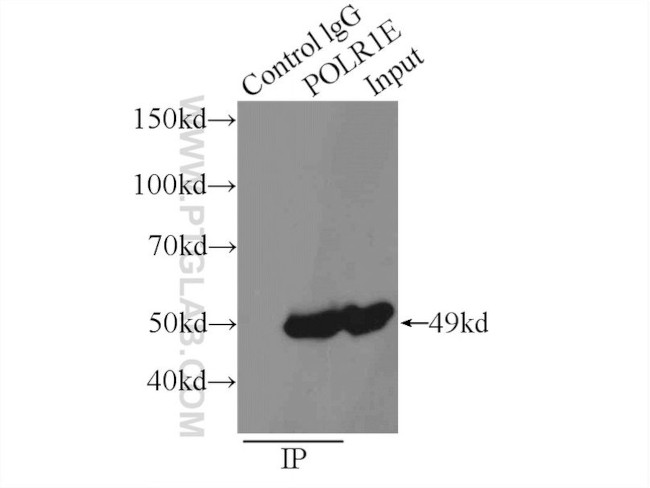 POLR1E Antibody in Immunoprecipitation (IP)