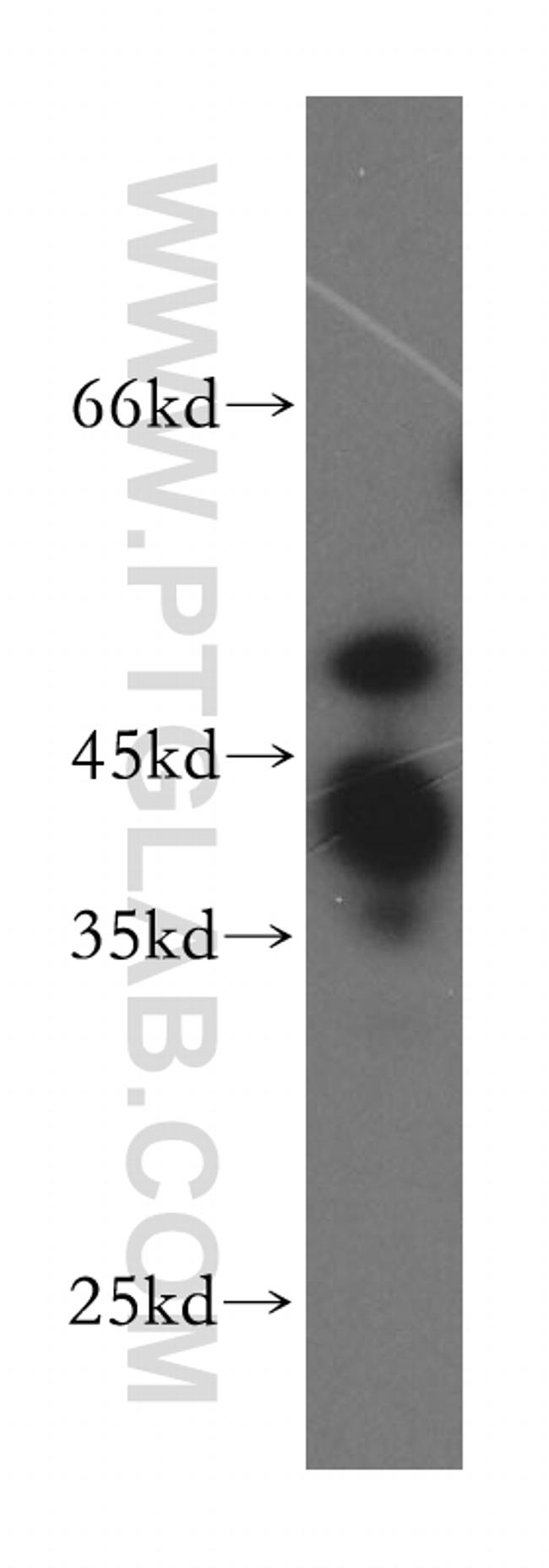 POLR1E Antibody in Western Blot (WB)