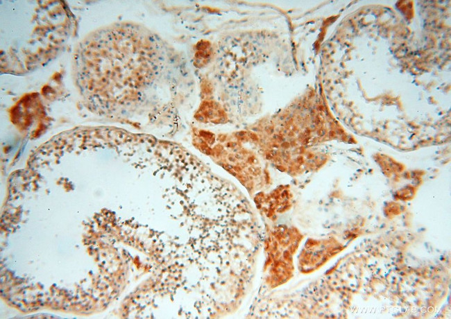 BAG1S/1M/1L Antibody in Immunohistochemistry (Paraffin) (IHC (P))