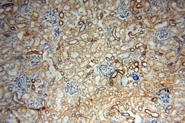 BAG1S/1M/1L Antibody in Immunohistochemistry (Paraffin) (IHC (P))