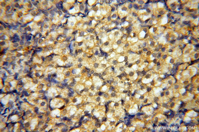 BAG1S/1M/1L Antibody in Immunohistochemistry (Paraffin) (IHC (P))