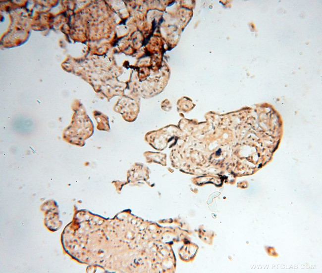 BAG1S/1M/1L Antibody in Immunohistochemistry (Paraffin) (IHC (P))