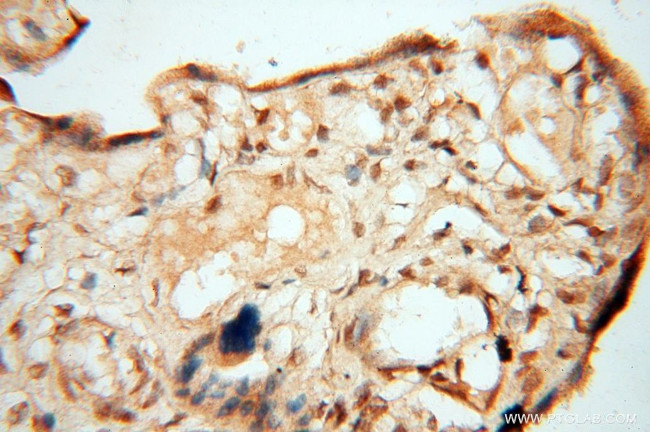 BAG1S/1M/1L Antibody in Immunohistochemistry (Paraffin) (IHC (P))