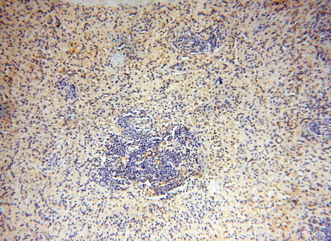 BAG1S/1M/1L Antibody in Immunohistochemistry (Paraffin) (IHC (P))