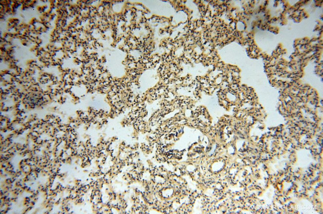 BAG1S/1M/1L Antibody in Immunohistochemistry (Paraffin) (IHC (P))