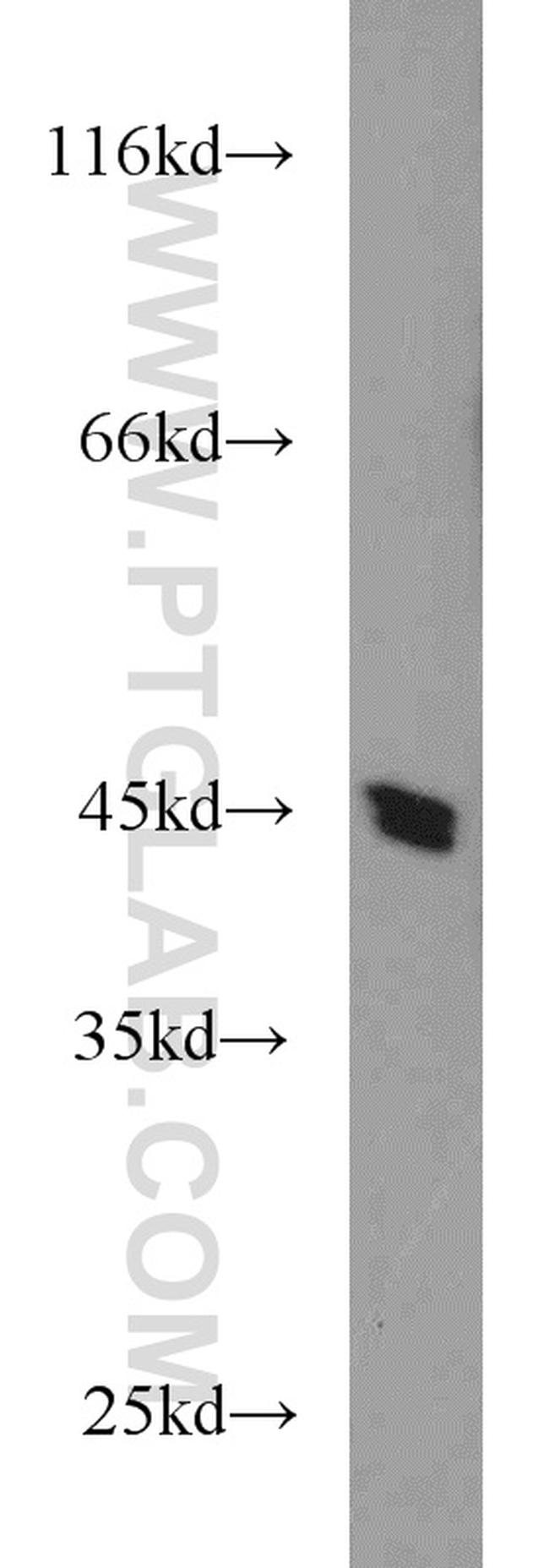 BAG1S/1M/1L Antibody in Western Blot (WB)