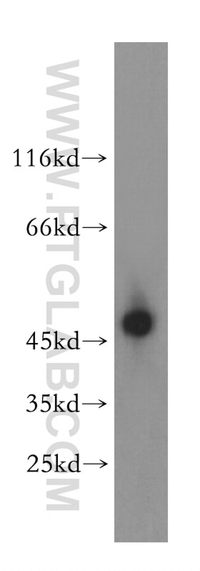 BAG1S/1M/1L Antibody in Western Blot (WB)