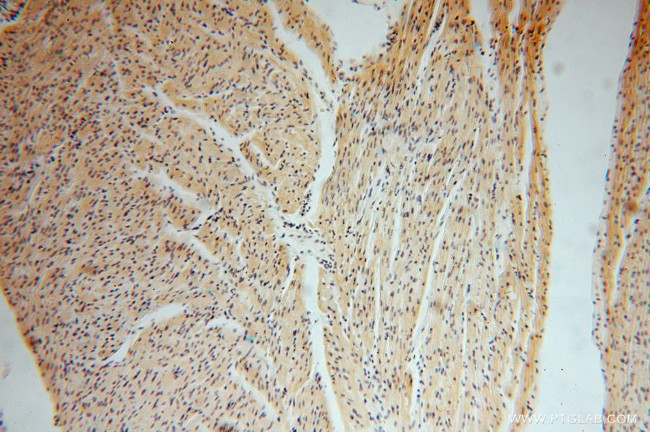 SMYD1 Antibody in Immunohistochemistry (Paraffin) (IHC (P))