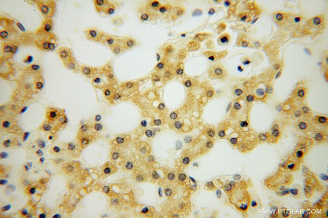 SMYD1 Antibody in Immunohistochemistry (Paraffin) (IHC (P))