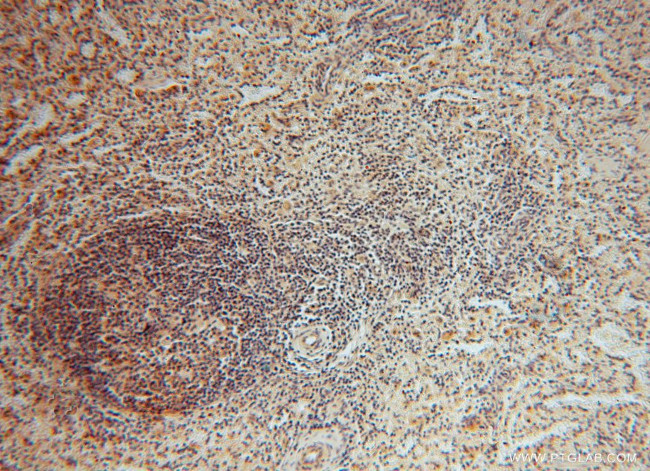 SMYD1 Antibody in Immunohistochemistry (Paraffin) (IHC (P))