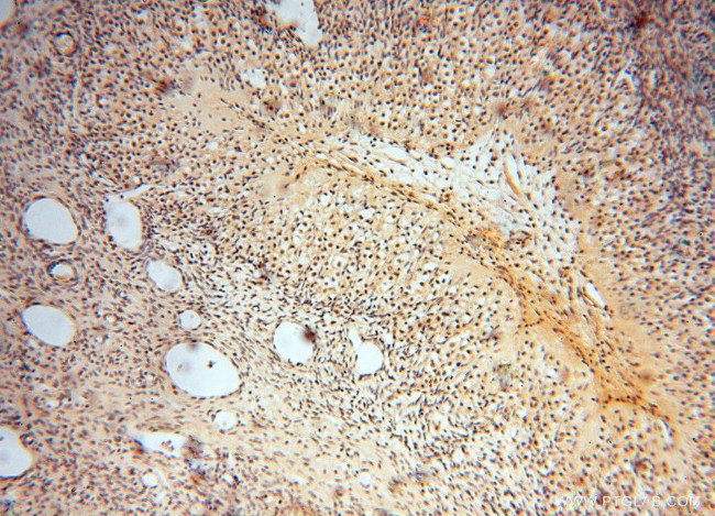 SMYD1 Antibody in Immunohistochemistry (Paraffin) (IHC (P))