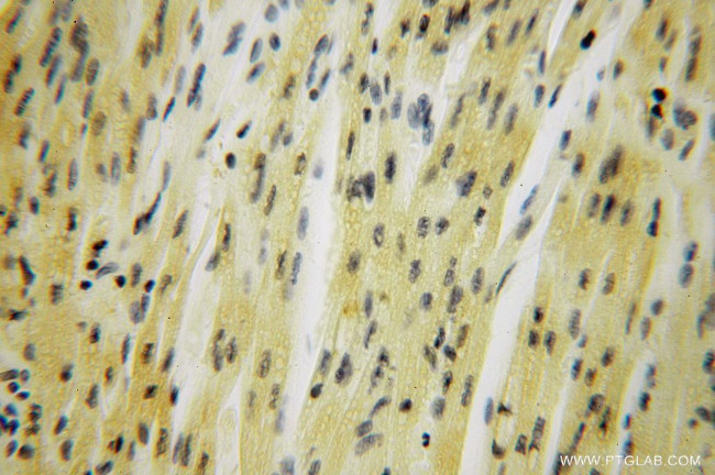 SMYD1 Antibody in Immunohistochemistry (Paraffin) (IHC (P))