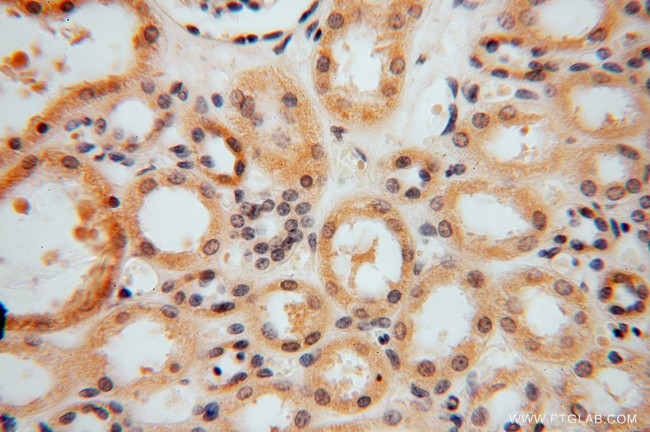 SMYD1 Antibody in Immunohistochemistry (Paraffin) (IHC (P))