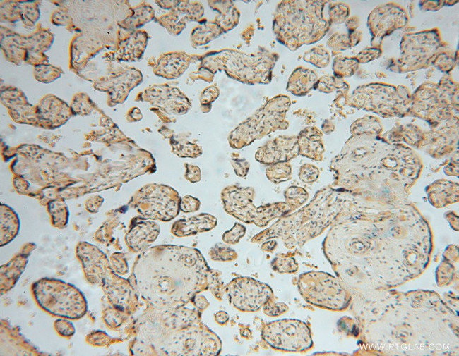 SMYD1 Antibody in Immunohistochemistry (Paraffin) (IHC (P))