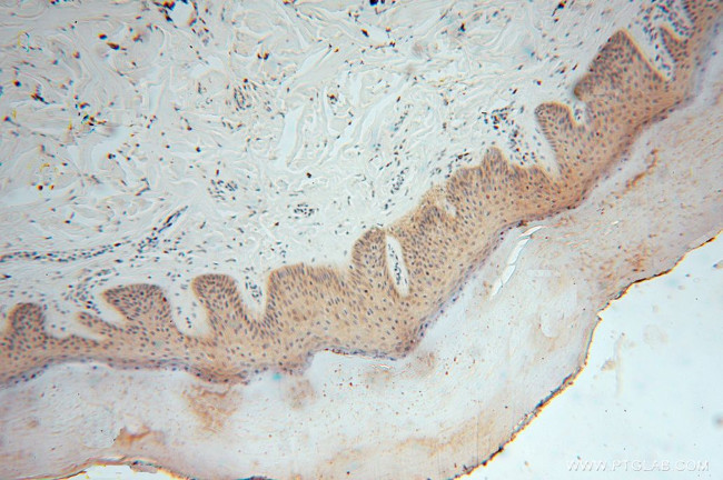 SMYD1 Antibody in Immunohistochemistry (Paraffin) (IHC (P))