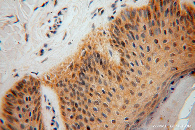 SMYD1 Antibody in Immunohistochemistry (Paraffin) (IHC (P))