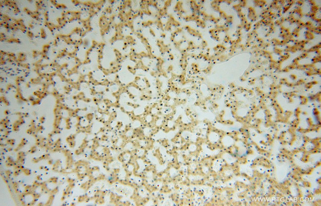 SMYD1 Antibody in Immunohistochemistry (Paraffin) (IHC (P))