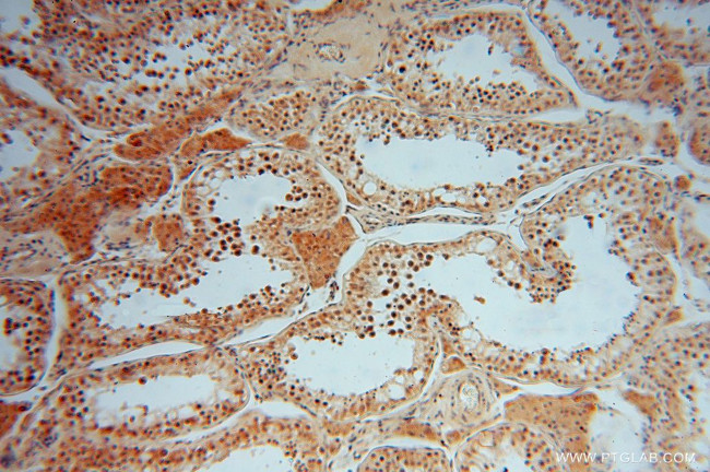 SMYD1 Antibody in Immunohistochemistry (Paraffin) (IHC (P))