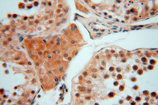 SMYD1 Antibody in Immunohistochemistry (Paraffin) (IHC (P))