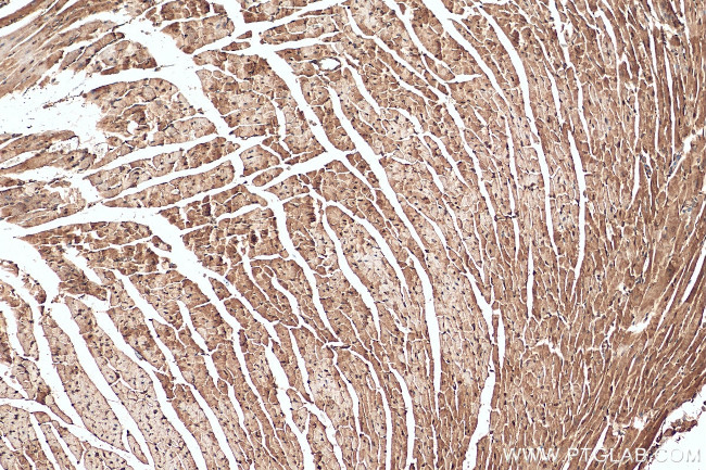 SMYD1 Antibody in Immunohistochemistry (Paraffin) (IHC (P))