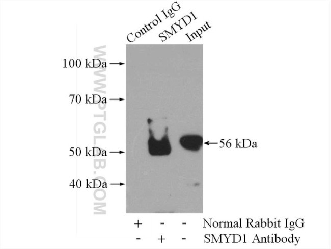 SMYD1 Antibody in Immunoprecipitation (IP)