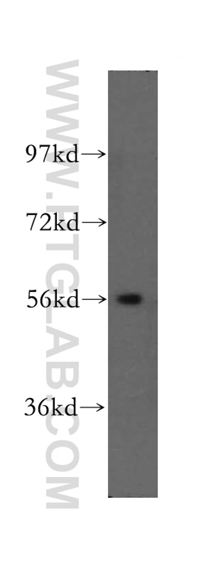 SMYD1 Antibody in Western Blot (WB)