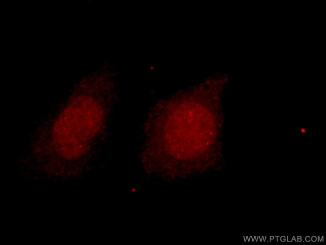 HDAC2 Antibody in Immunocytochemistry (ICC/IF)