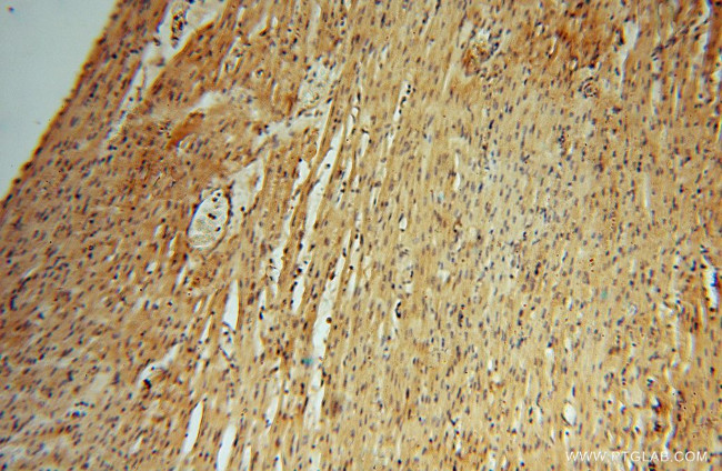 HDAC2 Antibody in Immunohistochemistry (Paraffin) (IHC (P))