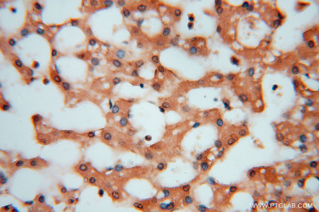 HDAC2 Antibody in Immunohistochemistry (Paraffin) (IHC (P))