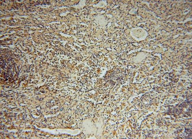 HDAC2 Antibody in Immunohistochemistry (Paraffin) (IHC (P))