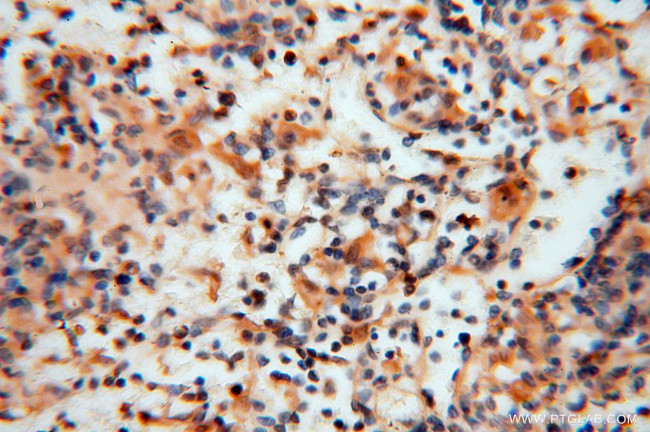 HDAC2 Antibody in Immunohistochemistry (Paraffin) (IHC (P))