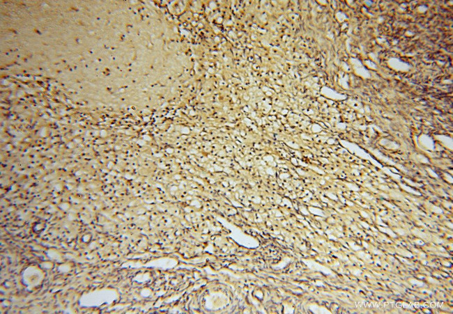 HDAC2 Antibody in Immunohistochemistry (Paraffin) (IHC (P))