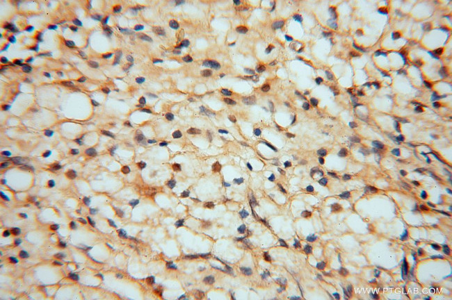 HDAC2 Antibody in Immunohistochemistry (Paraffin) (IHC (P))