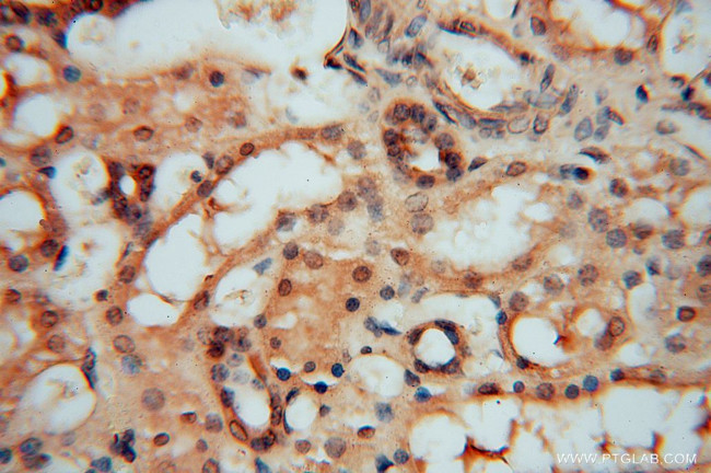 HDAC2 Antibody in Immunohistochemistry (Paraffin) (IHC (P))