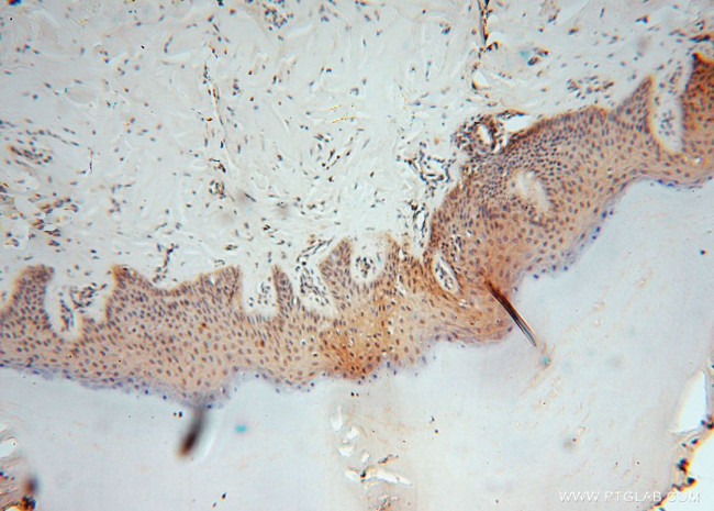 HDAC2 Antibody in Immunohistochemistry (Paraffin) (IHC (P))