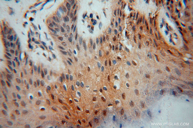 HDAC2 Antibody in Immunohistochemistry (Paraffin) (IHC (P))