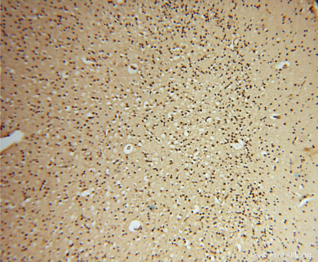 HDAC2 Antibody in Immunohistochemistry (Paraffin) (IHC (P))