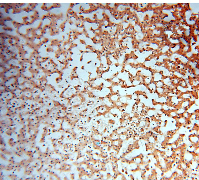 HDAC2 Antibody in Immunohistochemistry (Paraffin) (IHC (P))